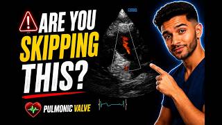 🚨 The Most Overlooked Valve in Echocardiography: What Every Sonographer Should Know