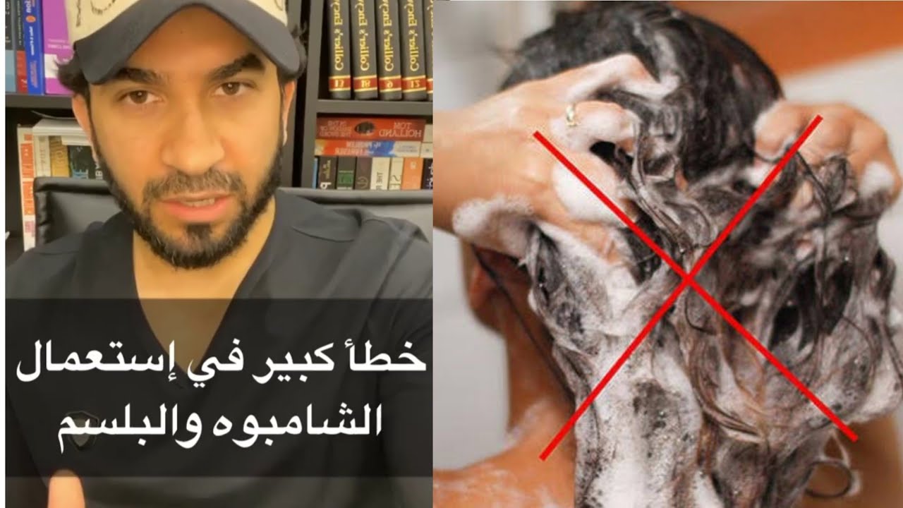 استخدام الشامبو والبلسم، خطأ كبير - دكتور طلال