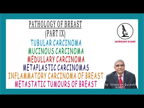 Tubular CA, Mucinous CA, Medullary CA, Metaplastic CA, Inflammatory CA, Metaplastic Tumors of Breast