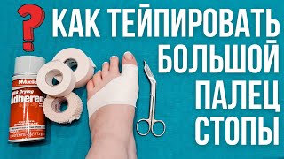 Как самостоятельно зафиксировать большой палец на ноге 🥋