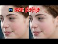 Easy Skin Retouching Photoshop Tutorial