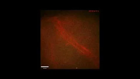 Non-infectious Lyme disease bacteria interacting with postcapillary venule in live mouse