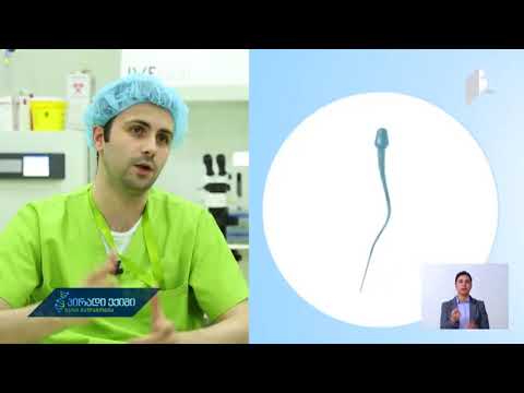 მამაკაცის შვილოსნობის კვლევის მეთოდები, ჰექტორ ჰუეტე ფერიზი გადაცემაში \"პირადი ექიმი\"