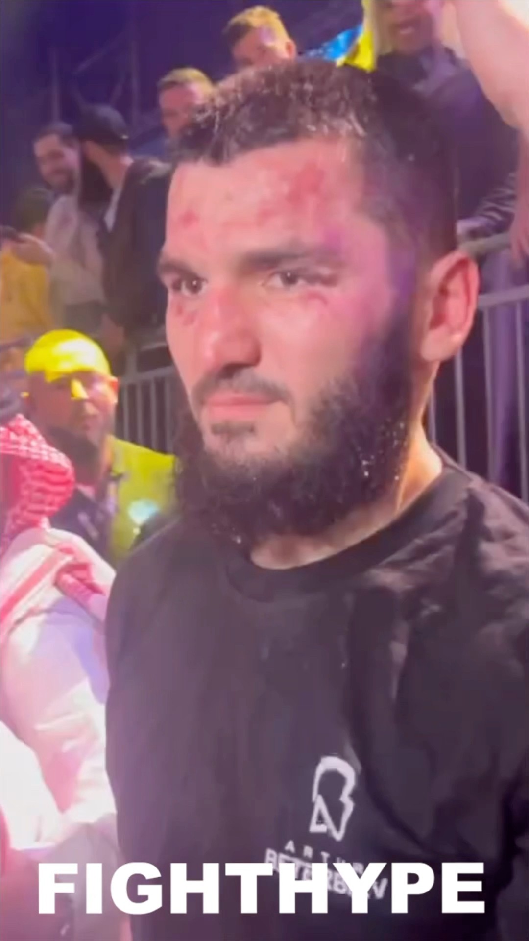 Artur Beterbiev IMMEDIATELY AFTER LOSING to Dmitry Bivol; STORMS PAST Teofimo Lopez BRUISED UP