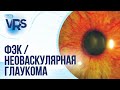 Сахарный диабет / Диабетическая ретинопатия/ Факоэмульсификация катаракты /Неоваскулярная глаукома
