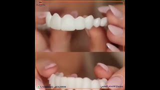 سناب أون سمايل | Snap on smile