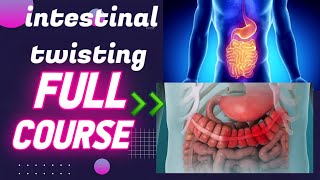 Understanding Intestinal Twisting: A Comprehensive Guide to Diagnosis, Treatment, and Prevention