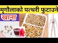     symptoms and causes of kidney stone  nepali health tips