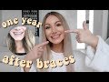 1 YEAR AFTER BRACES | Have my teeth moved?