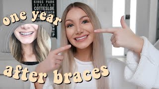 1 YEAR AFTER BRACES | Have my teeth moved?