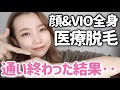 【本気解説】顔・VIO込み全身の医療脱毛通い終わった結果。硬毛化や痛み、効果について◎