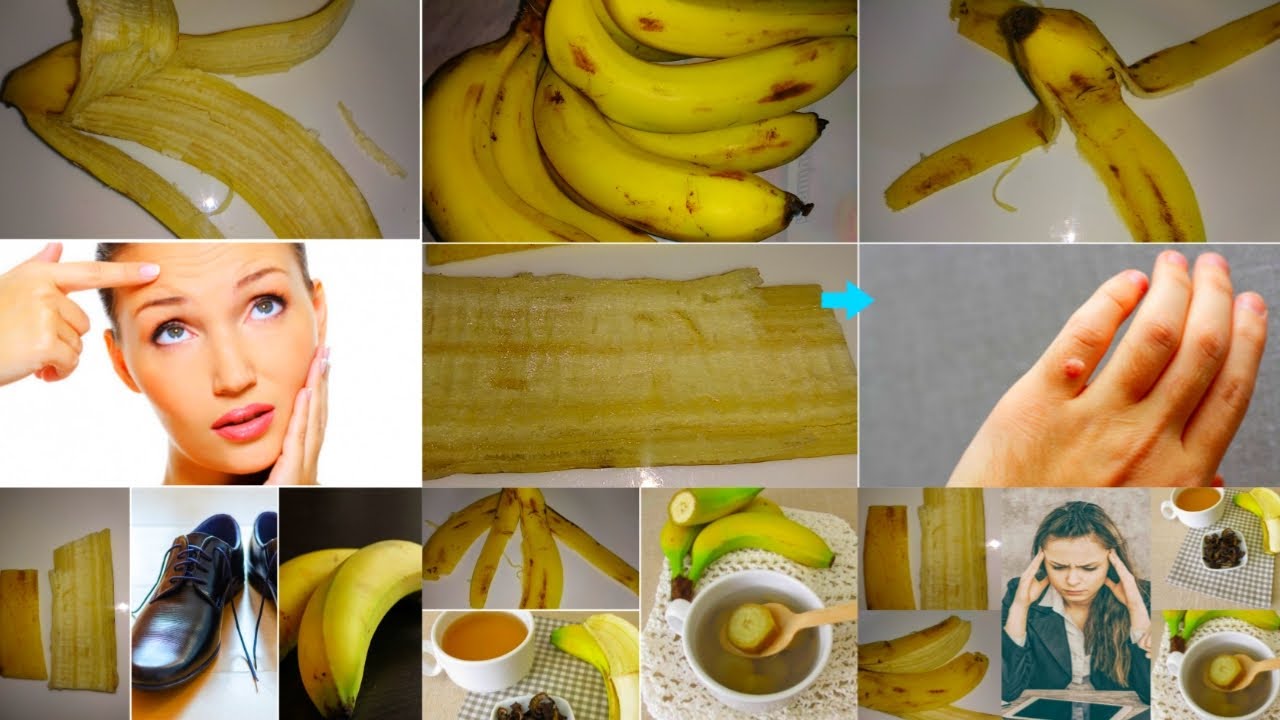 केले के छिलके के चोकाने वाले फायदे Amazing benefits of banana peel