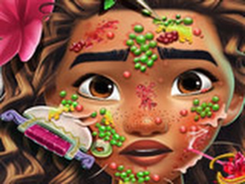 Мультик:Лечить Кожу Принцессе Моане/Treat Skin Princess Moaña