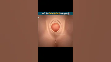 बच्चे की नॉर्मल डिलीवरी कैसे होता है? | Normal Delivery | Modvr-3D