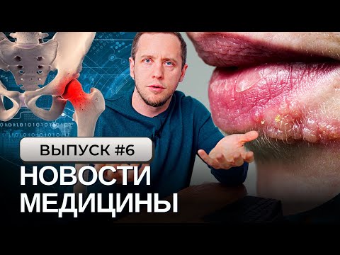 ШОК Польза пива доказана наукой | Некроз ТБС после ковид | Страшные боли от герпеса | Хурма-убийца