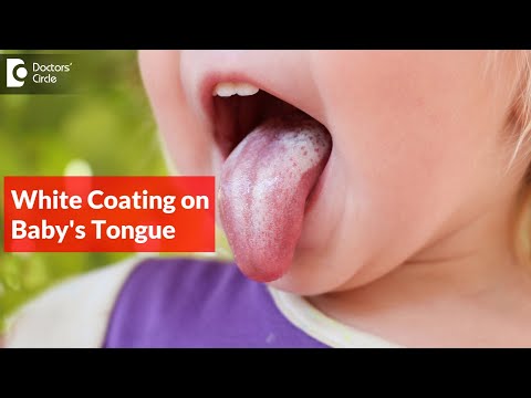 White coating on tongue of baby. Why It Happens and How to Treat It? -Dr. K Saranya |Doctors' Circle