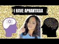 I HAVE APHANTASIA!!! #aphantasia