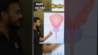 Rape Victim की जांच कैसे करते हैं ? #shorts