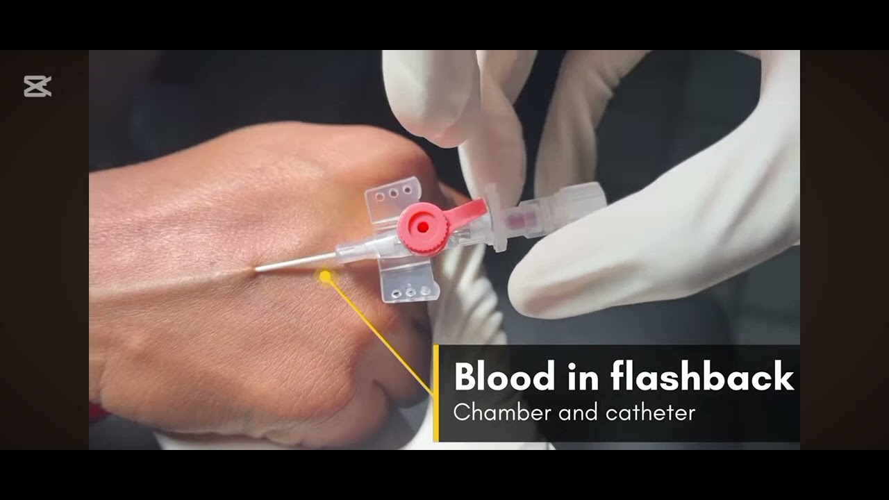 Iv Light Insert IV CANNULA INSERT #foryou #vlog #minivlog #support #mbbs #viralvideo ...