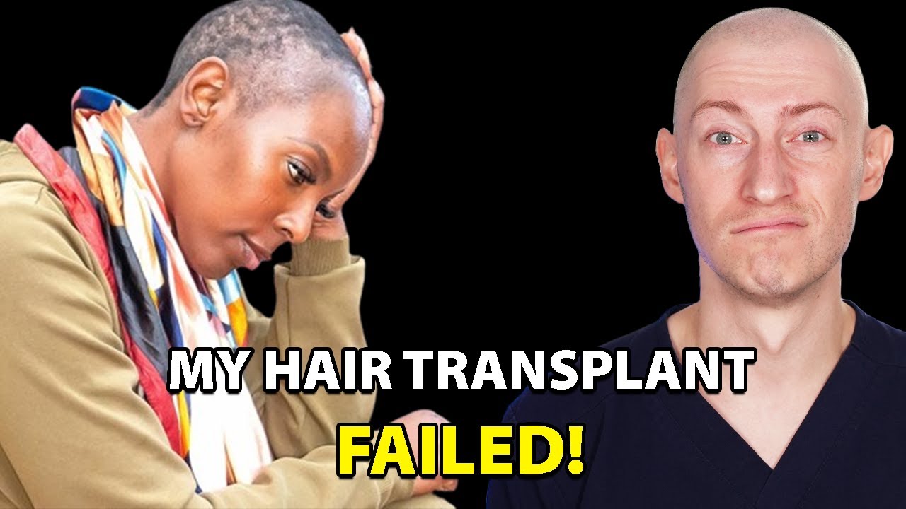 Hair Transplant Failure: Surgeon's Reaction and Analysis | Dr. Gary Linkov