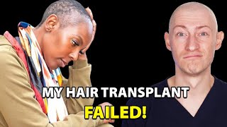 My Hair Transplant Did Not Work | Hair Surgeon Reacts