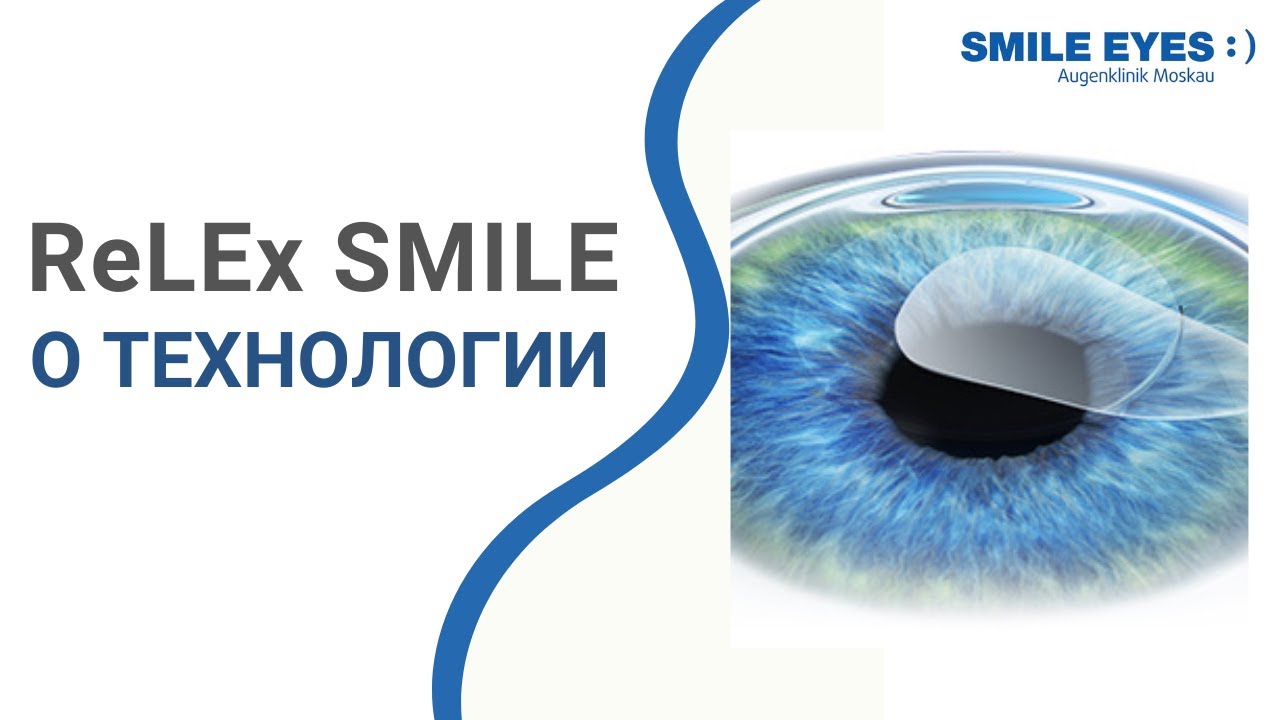 Relex smile отзывы