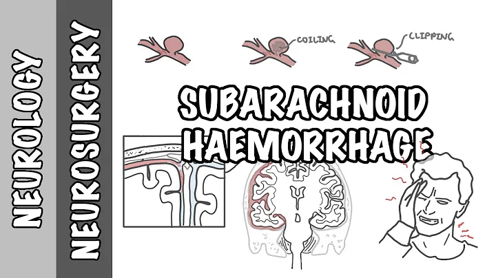 Subarachnoid Haemorrhage / pathophysiology, complications and management - DayDayNews