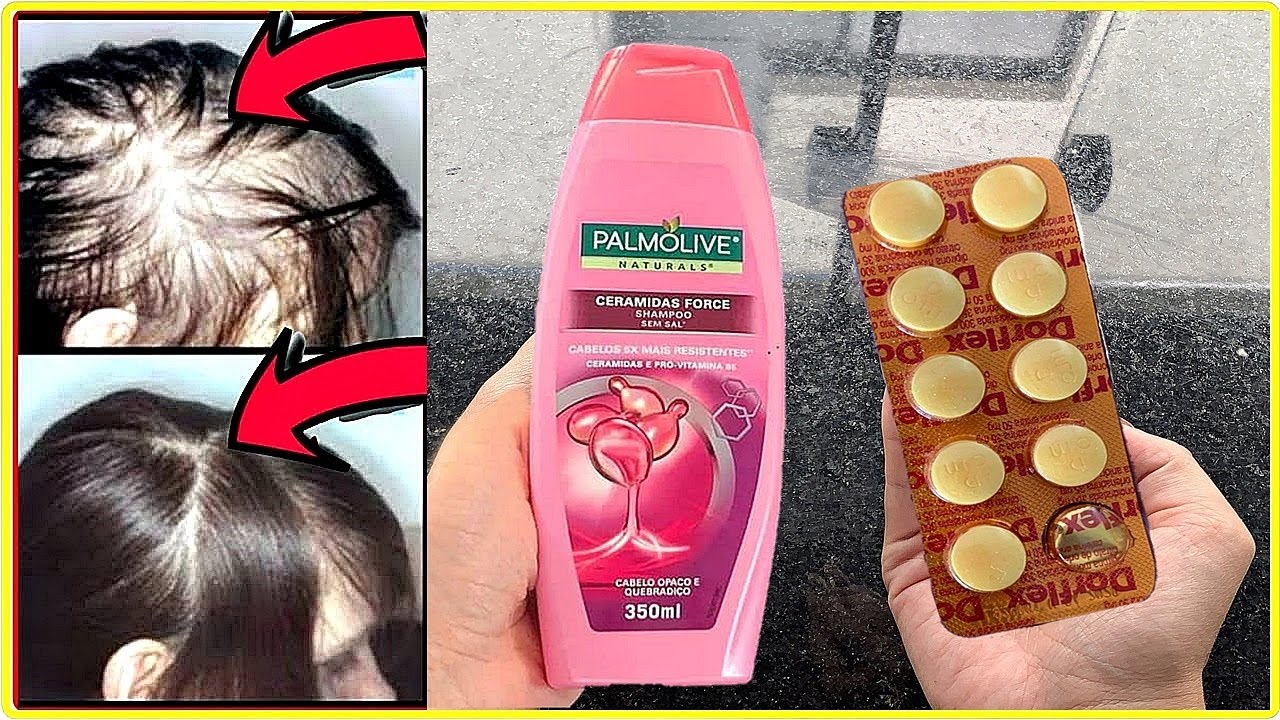 ATÉ CARECA FICA CABELUDO JOGANDO ISSO NO SHAMPOO/ Nasce Cabelo Até na Testa, Nunca + Cai 1 Fio...
