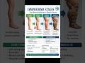 LYMPHEDEMA STAGES #medical #shorts