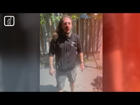 ფიზიკური ძალადობა ზუკა ბერძენიშვილზე