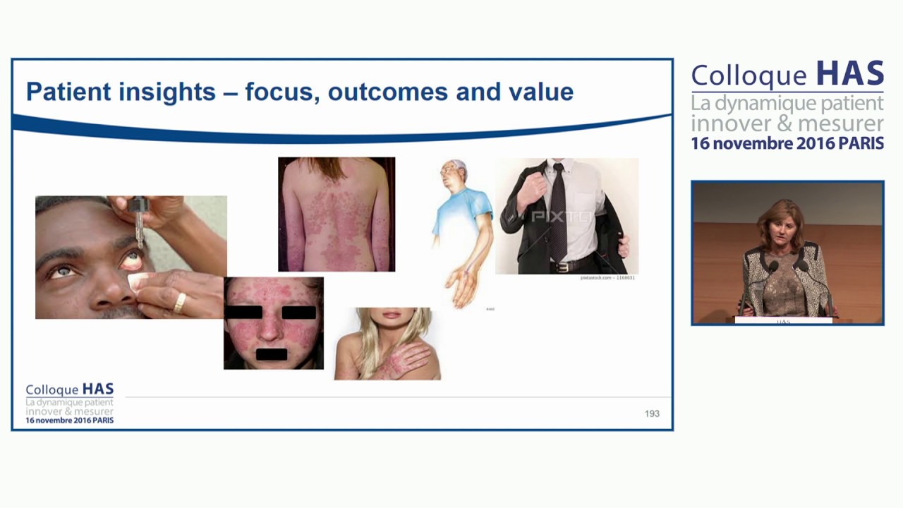 Session 3 – The patient perspective in health technology assessment