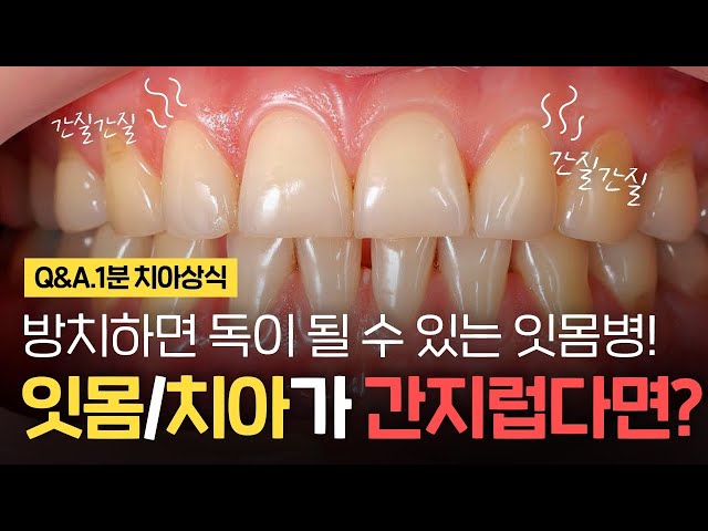 잇몸이나 이가 간지러운 이유는? 갑자기 간지러울때!
