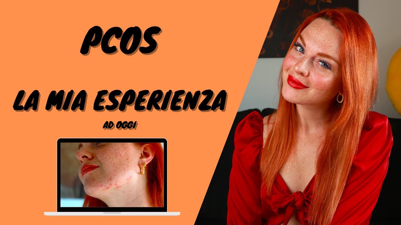 PCOS: LA MIA ESPERIENZA (ad oggi)