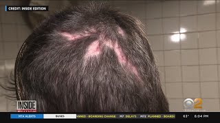 Subway hammer attack victim recounts assault