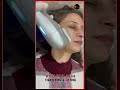 HIFU Skin Tightening & Lifting | Non-Surgical Face Lift | Asthederm (Aesthetic By Jasmine)