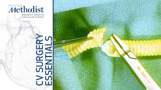 End To End Anastomosis (Eric K. Peden, MD, M. Mujeeb Zubair, MD) End To End Anastomosis (Eric K. Peden, MD, M. Mujeeb Zubair, MD)