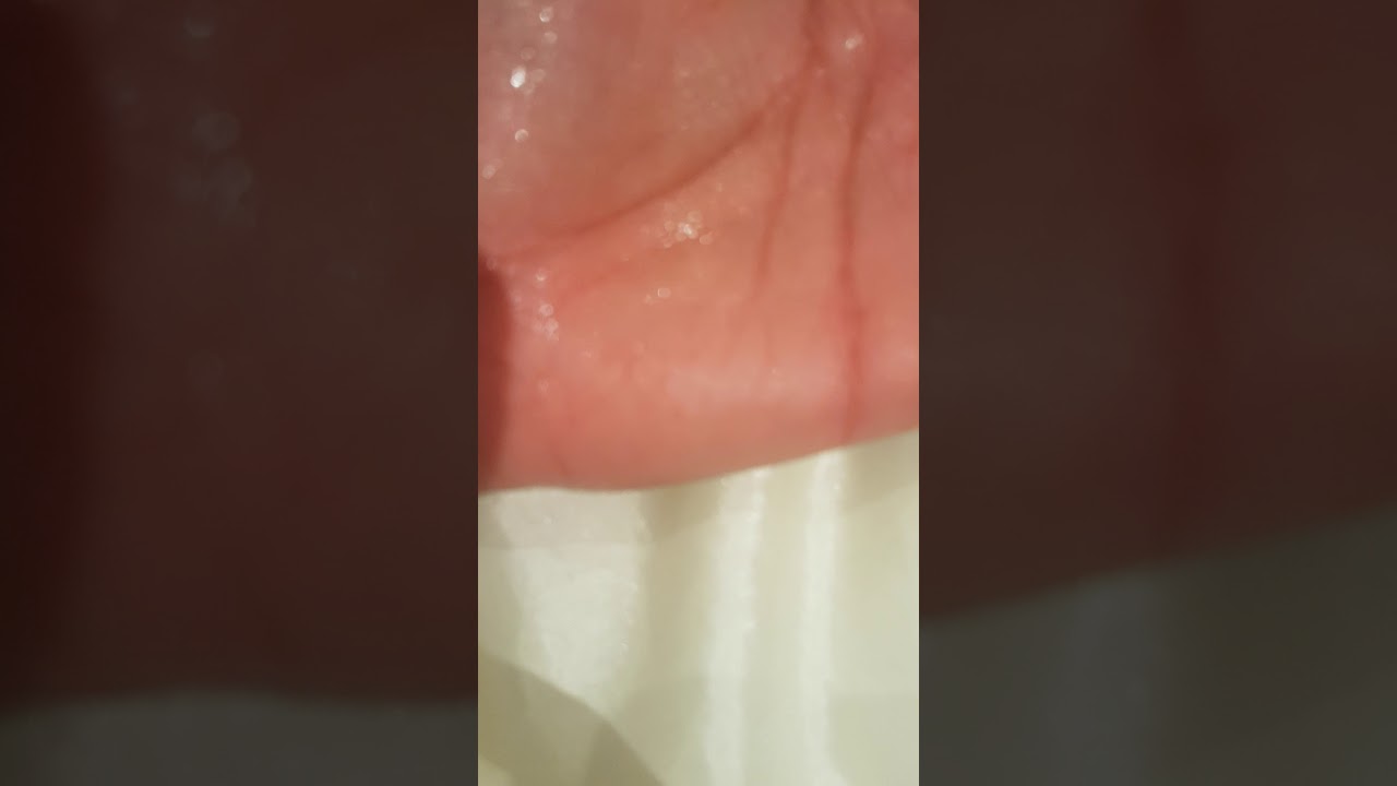 Wow Chhinkini fit, showing spray, hitching, blowing