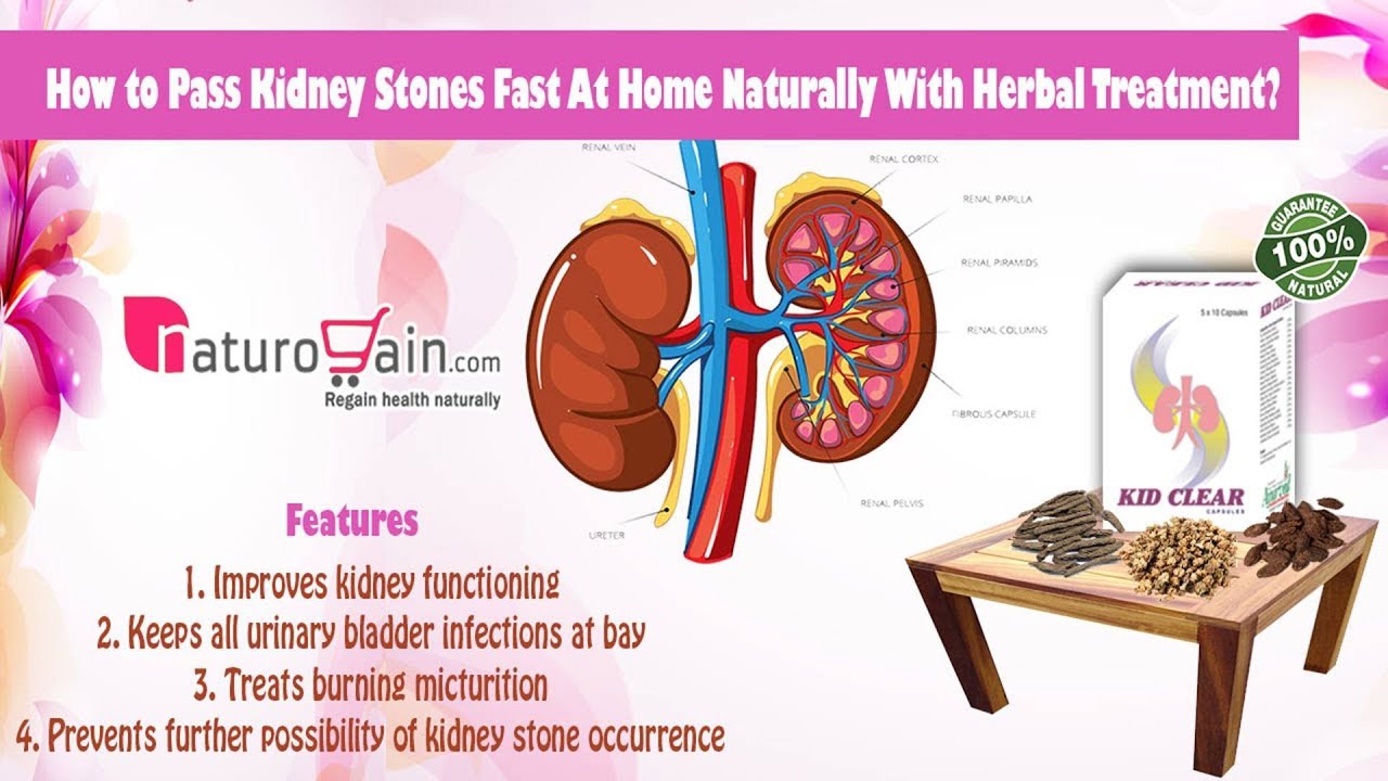How to Pass Kidney Stones Fast At Home Naturally With Herbal Treatment