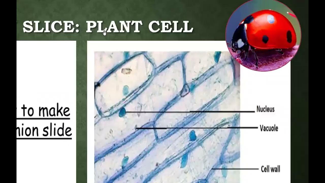 Onion and Cheek cells YouTube