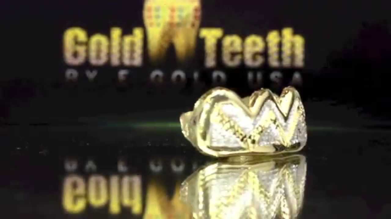 Gold Teeth