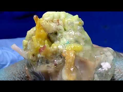 Most Perplexing Cases Ever Sandra Lee  無心で見れる動画  110703 1064