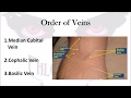 Phlebotomy: The Order of Veins