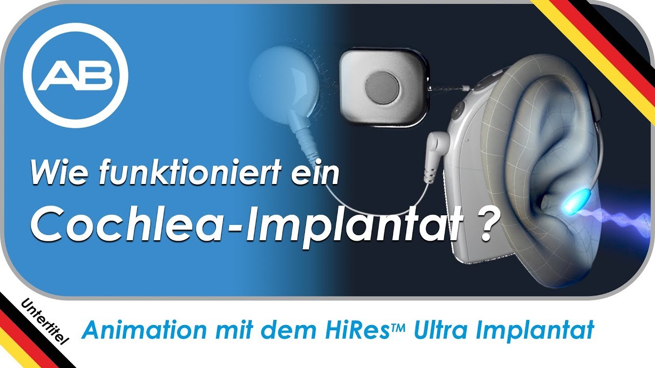 Wenn Horgerate Nicht Mehr Helfen