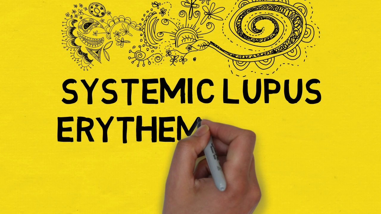 Patofisiologi SLE (Systemic Lupus Erythematosus) : Antibodi Pengkhianat