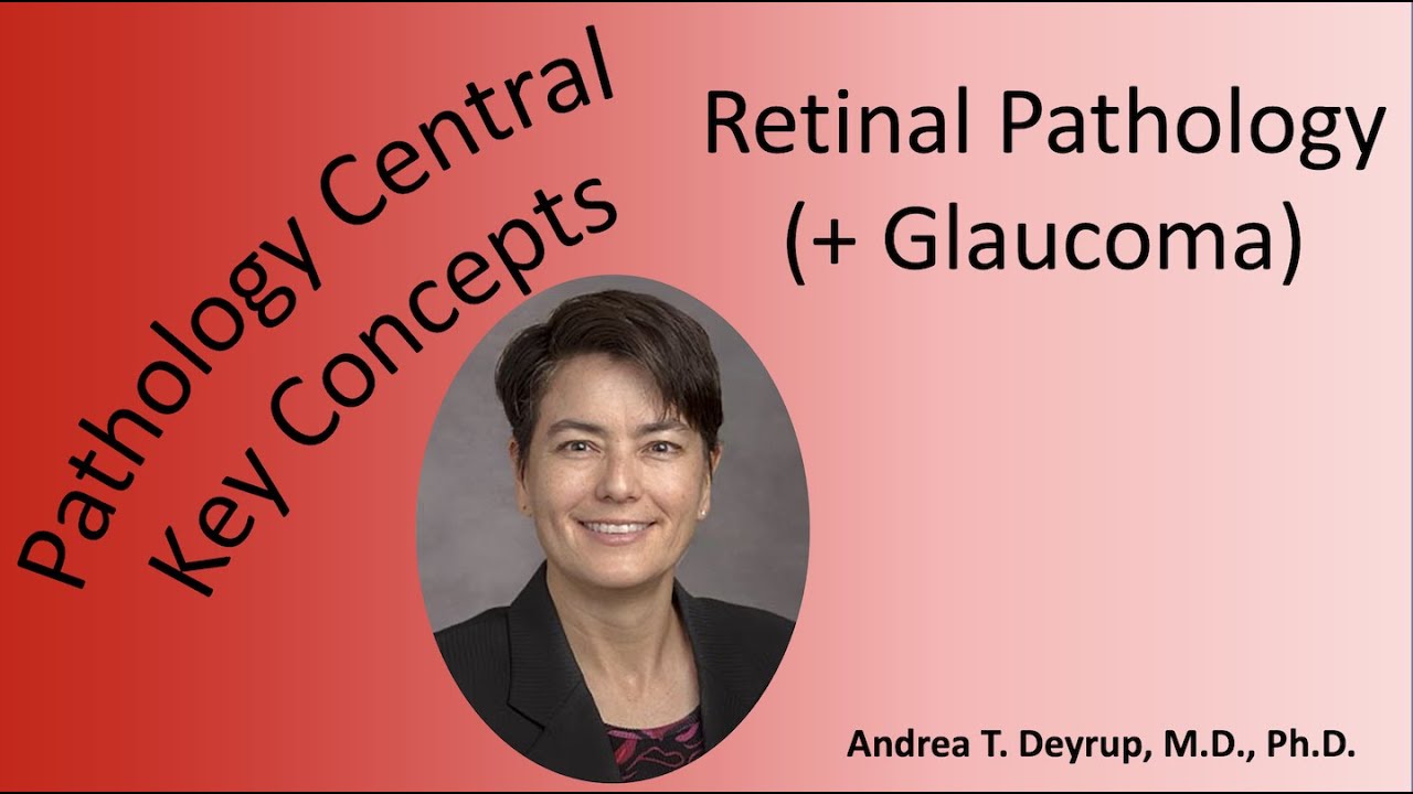Medical School Pathology: Retinal Pathology (+ Glaucoma)
