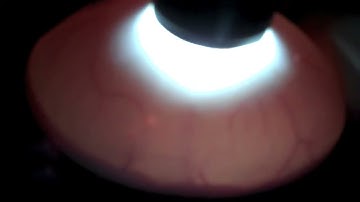 Candling Snake Eggs & Ball Python