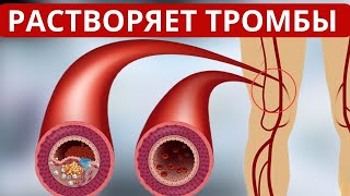 ЭТО РАСТВЛРЯЕТ ТРОМБЫ! Всего  ОДНА Чашка и 2-3 дольки....