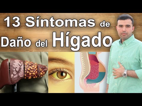 Hígado Dañado - 13 Síntomas Que Puedes Tener Daño Hepático
