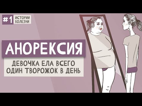 Анорексия. Девочка ела всего один творожок в день | Истории болезни #1