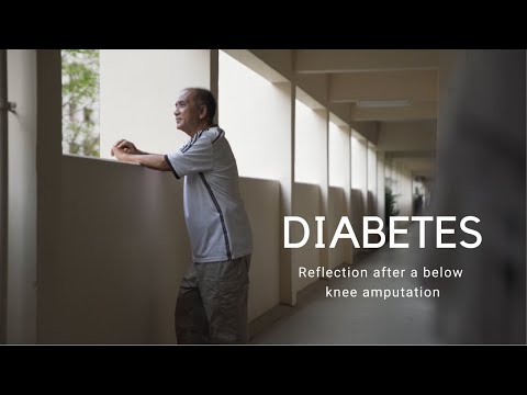 Thumbnail for the embedded element "Diabetes: Reflection after a below knee amputation"